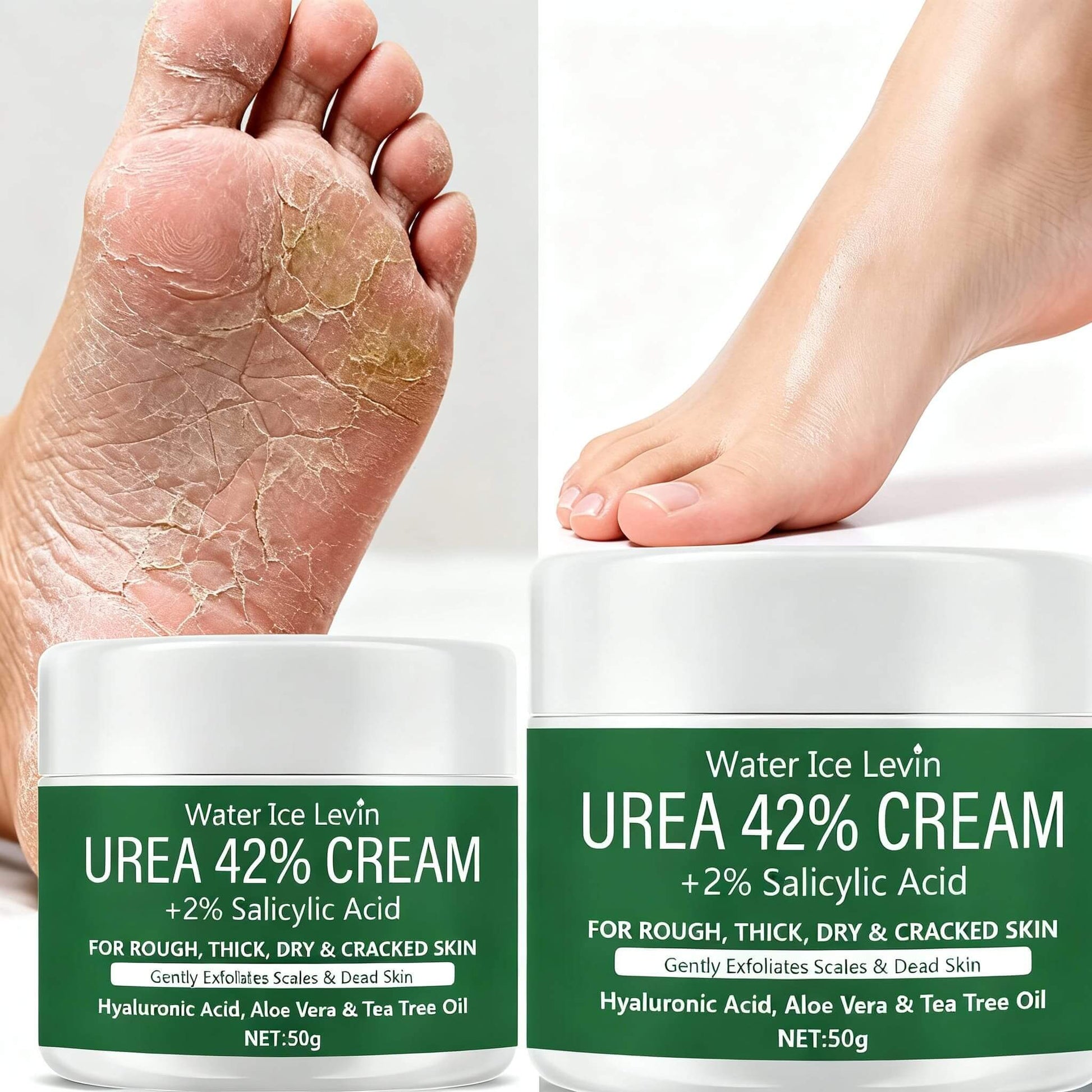 Crema piedi Urea 42%, trattamento intensivo per talloni screpolati, idratazione profonda, pelle secca e calli, piedi morbidi e curati