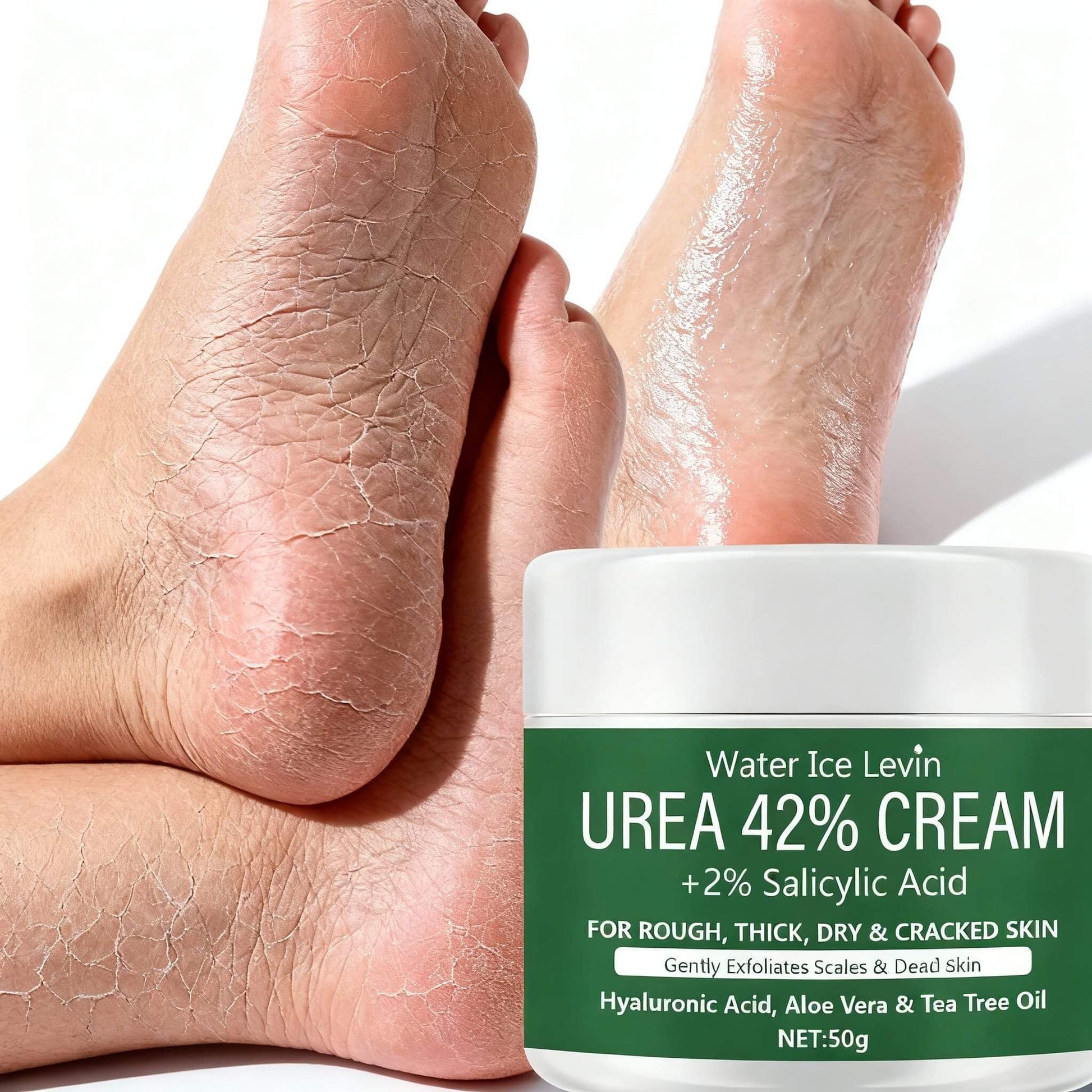 Crema piedi Urea 42%, trattamento intensivo per talloni screpolati, idratazione profonda, pelle secca e calli, piedi morbidi e curati