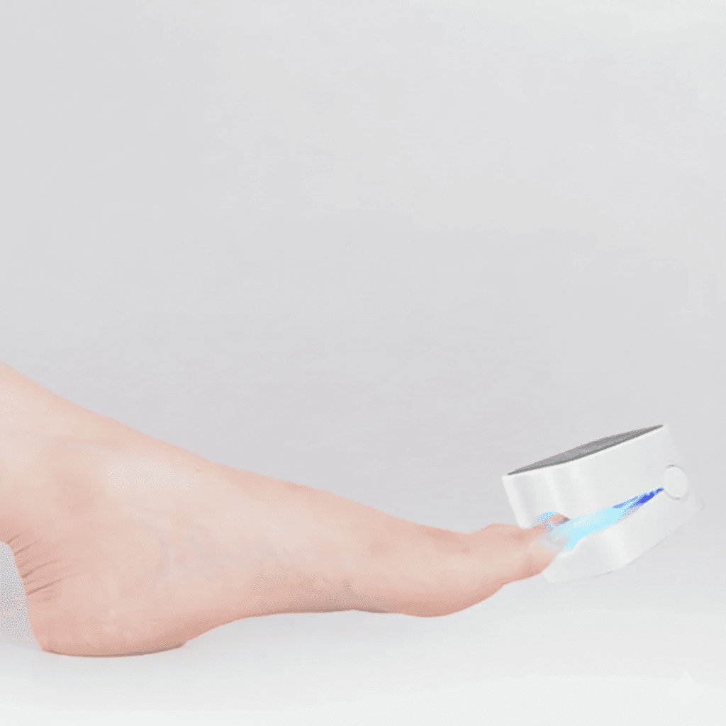 LaserNail dispositivo laser anti‑fungine per unghie dei piedi – terapia LLLT per onicomicosi, eliminazione del fungo, unghie più sane