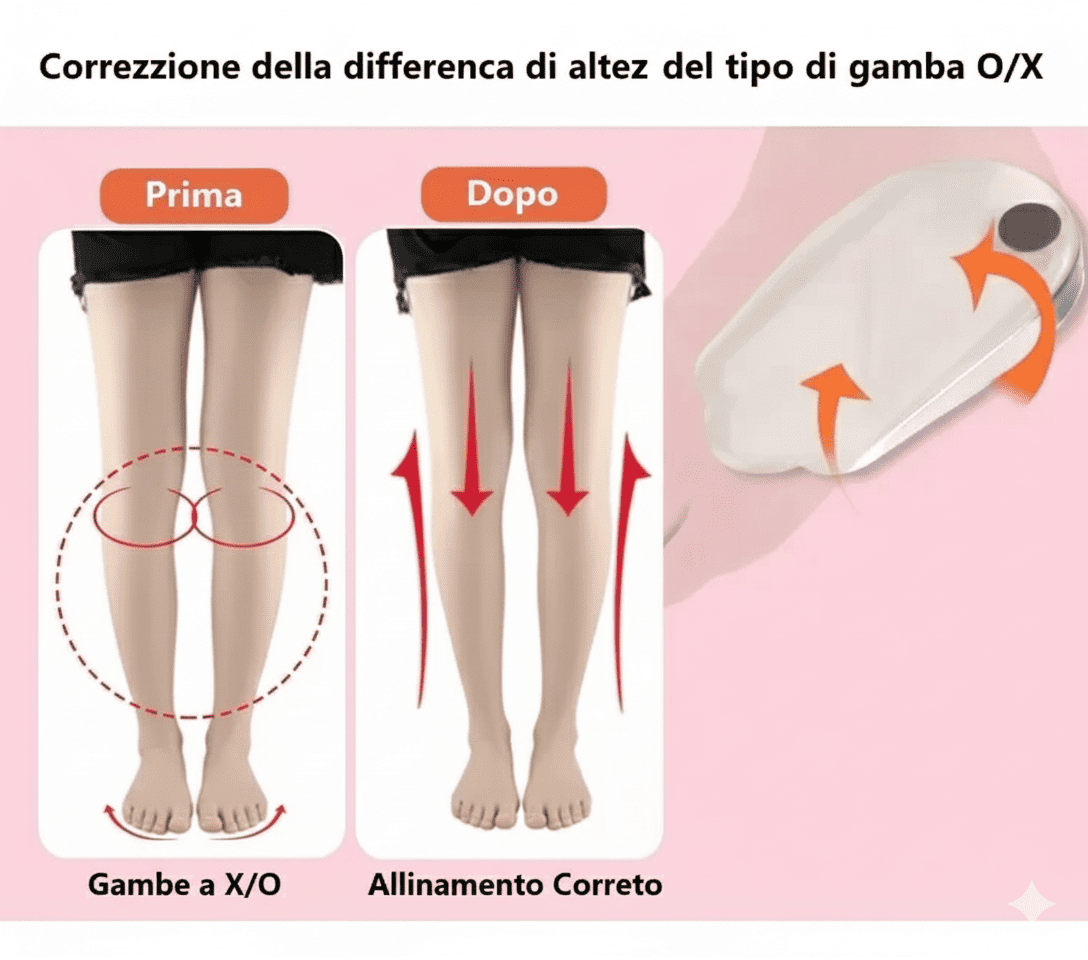 Orthotic Insoles solette ortopediche magnetiche per correzione gambe O/X, supporto plantare, allineamento postura, sollievo dolore pied