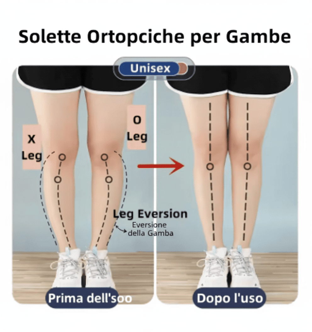 Orthotic Insoles solette ortopediche magnetiche per correzione gambe O/X, supporto plantare, allineamento postura, sollievo dolore pied